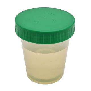 Urinprobenbecher 125ml, mit grünem Schraubdeckel
