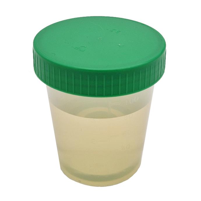 Urinprobenbecher 125ml, mit grünem Schraubdeckel